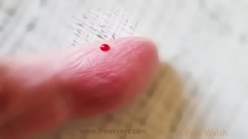 Blood Glucose Monitor